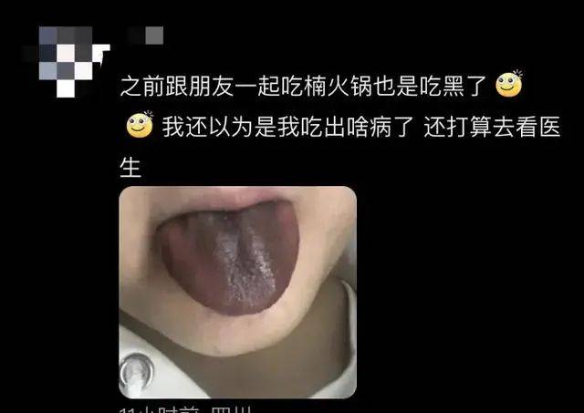 母女俩在网红火锅店吃完舌头变黑，商家通报：涉事店已关闭，原因待查  第6张