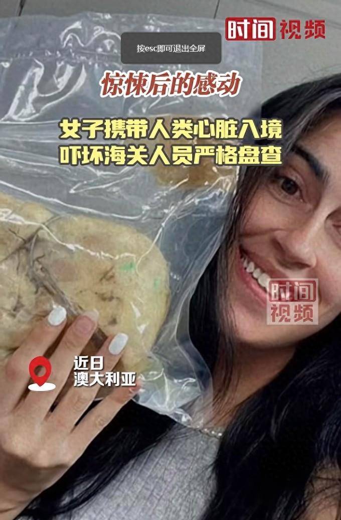 女子携带人类心脏入境澳大利亚被拦，曾接受移植手术，真空密封“旧心脏”  第1张